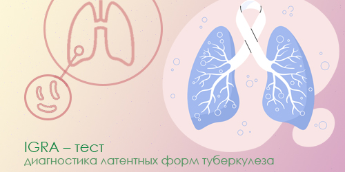 ИГРА-TБ (IGRA-ТВ)