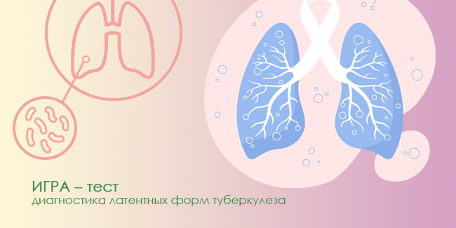 ИГРА-TБ (IGRA-ТВ)