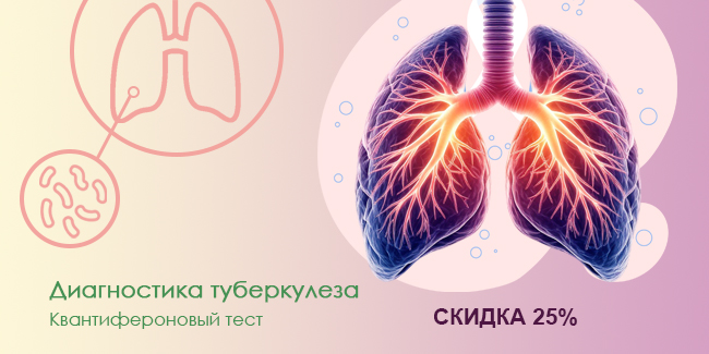 Диагностика туберкулеза с 25% скидкой